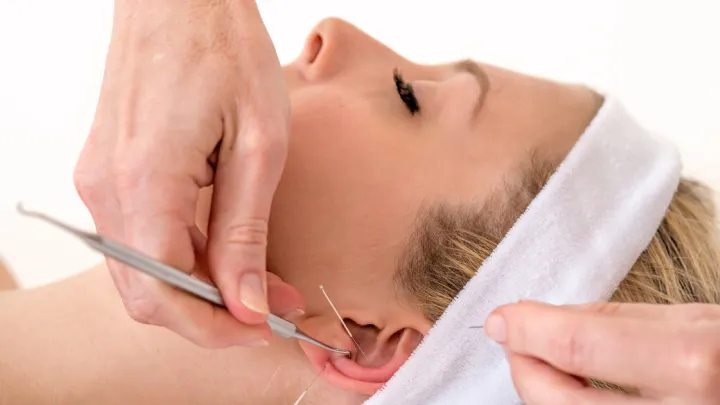Woman getting acupuncture on ear